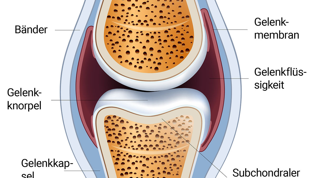 Subchondraler Knochen