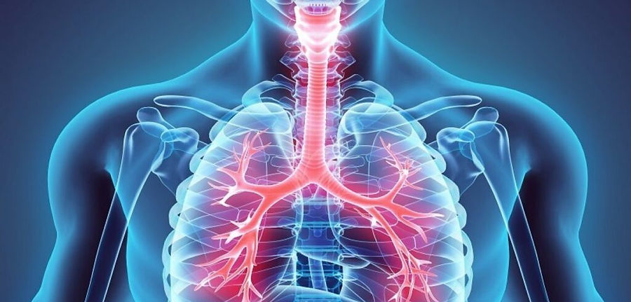 COPD