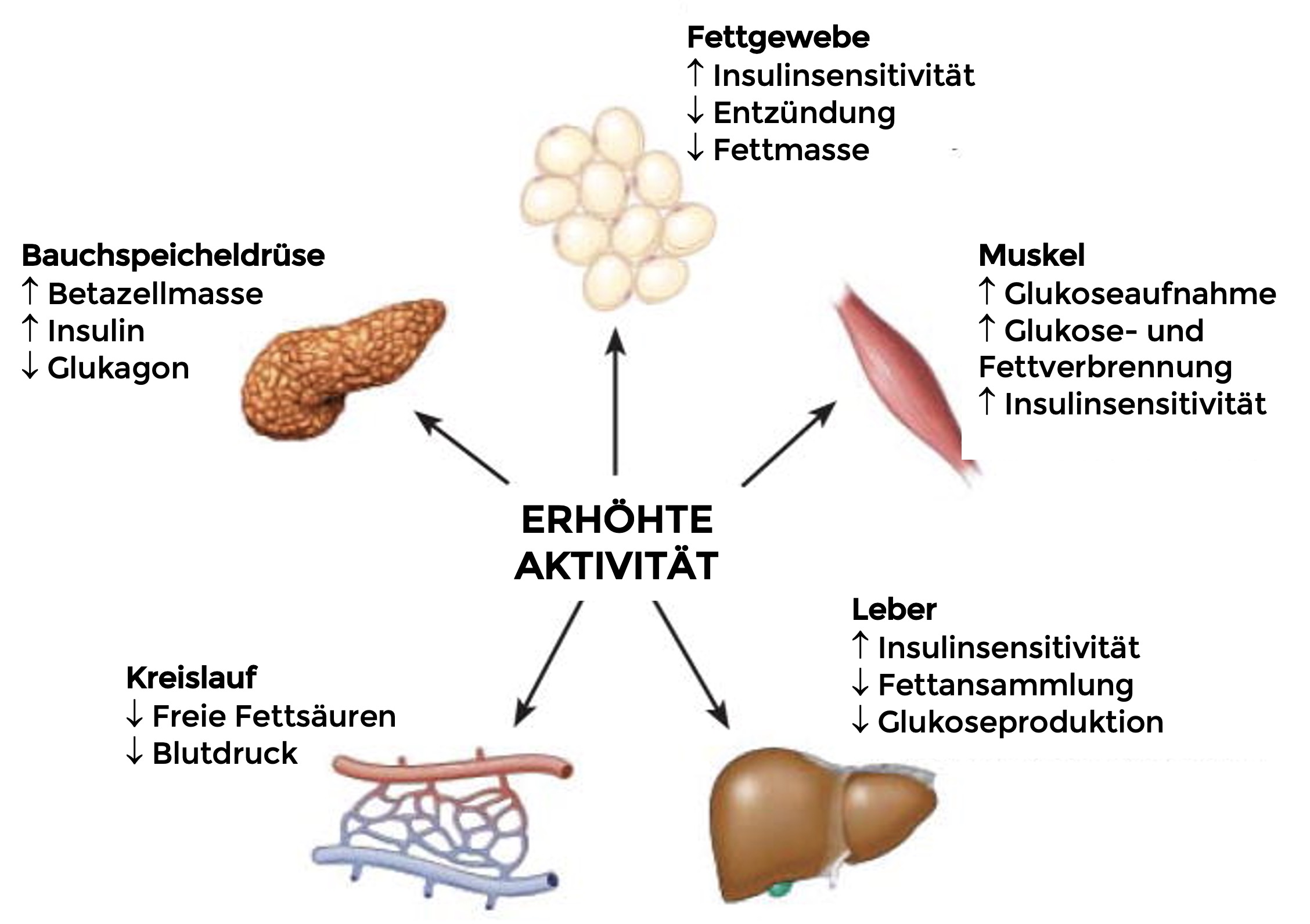 Effektübersicht erhöhte Aktivität bei Diabetes