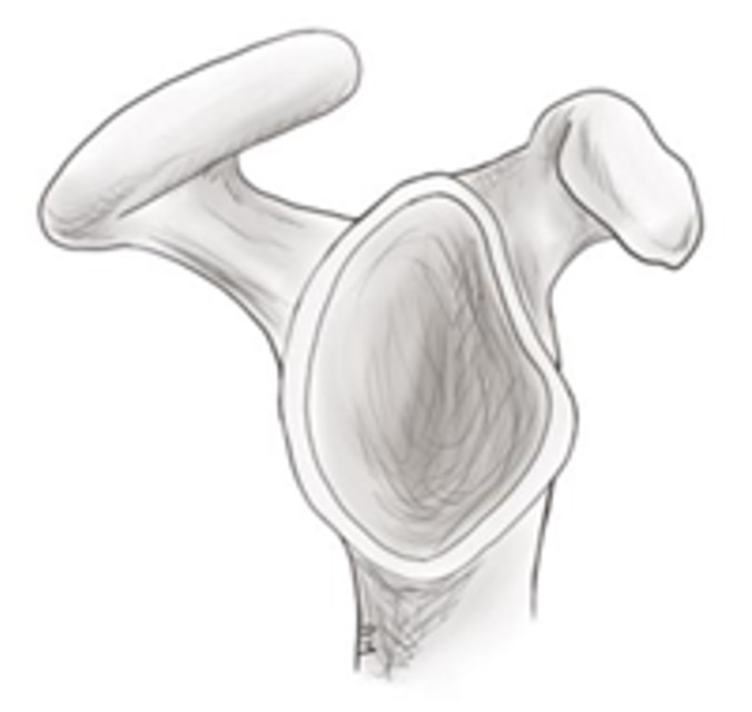 Acromion Typ 1